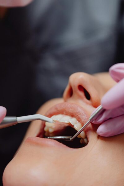 Dicas Essenciais para uma Saúde Bucal Impecável: Cuidados e Prevenção para Sorrisos Saudáveis
