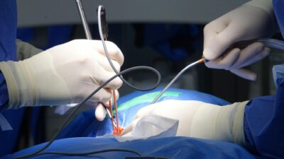 Endoscopia da Coluna: Alívio Eficaz para a Dor Crônica e Melhora da Saúde da Coluna