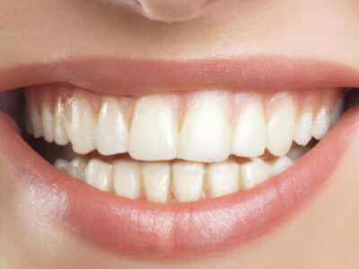 Como Combater o Mau Hálito: Dicas de Higiene Oral para um Hálito Fresco e Bem-Estar